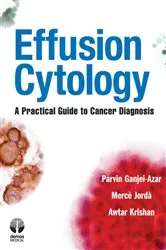 Book cover of Effusion Cytology by Parvin Ganjei-Azar