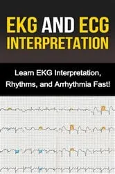 Book cover of EKG and ECG Interpretation by Alyssa Stone