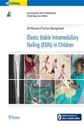 Book cover of Elastic Stable Intramedullary Nailing (ESIN) in Children by Hans-Georg Dietz