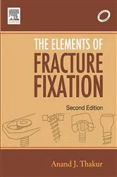 Book cover of Elements of Fracture Fixation - E-Book (2nd ed.) by Thakur MS(Ortho), FCPS, Dortho, Anand J.