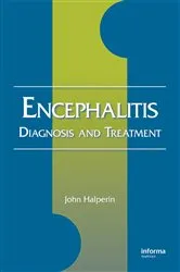 Book cover of Encephalitis by John Halperin