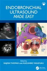 Book cover of Endobronchial Ultrasound Made Easy by Rajesh Thomas