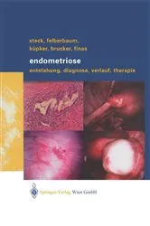 Book cover of Endometriose by Thomas Steck