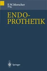 Book cover of Endoprothetik by E. Morscher