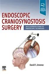 Book cover of Endoscopic Craniosynostosis Surgery E-Book by David F. Jimenez