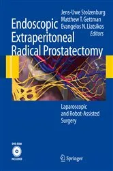 Book cover of Endoscopic Extraperitoneal Radical Prostatectomy by J.-U. Stolzenburg
