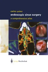 Book cover of Endoscopic Sinus Surgery by Carlos Yañez