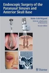Book cover of Endoscopic Surgery of the Paranasal Sinuses and Anterior Skull Base (2nd ed.) by Malte Erik Wigand