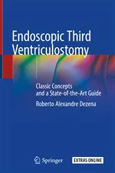 Book cover of Endoscopic Third Ventriculostomy by Roberto Alexandre Dezena