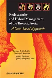 Book cover of Endovascular and Hybrid Management of the Thoracic Aorta by Edward B. Diethrich
