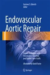 Book cover of Endovascular Aortic Repair by Gustavo S. Oderich