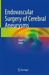 Book cover of Endovascular Surgery of Cerebral Aneurysms by Xianli Lv