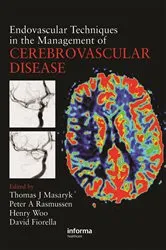 Book cover of Endovascular Techniques in the Management of Cerebrovascular Disease by Thomas J. Masaryk