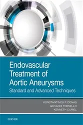 Book cover of Endovascular Treatment of Aortic Aneurysms by Donas MD, PhD, Konstantinos P.