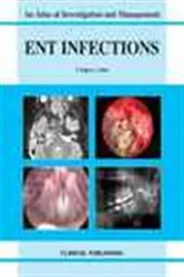 Book cover of ENT Infections by Unknown