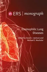 Book cover of Eosinophilic Lung Diseases by David J. Jackson
