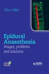 Book cover of Epidural Anaesthesia: Images, Problems and Solutions by Clive Collier