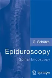 Book cover of Epiduroscopy by Günter Schütze