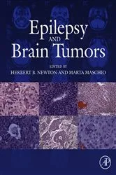 Book cover of Epilepsy and Brain Tumors by Herbert B. Newton MD in Oncology-Neurosurgery
