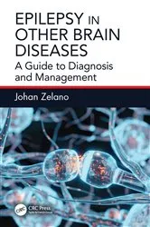 Book cover of Epilepsy in Other Brain Diseases by Johan Zelano