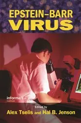 Book cover of Epstein-Barr Virus by Jeffrey Winzant