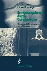 Book cover of ErmÃ¼dungsbruch durch Osteoporose by Kurt G. Wurster