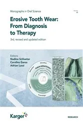 Book cover of Erosive Tooth Wear: From Diagnosis to Therapy (3rd ed.) by Unknown