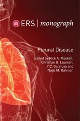 Book cover of ERS Monograph by Nick A Maskell