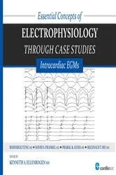 Book cover of Essential Concepts of Electrophysiology through Case Studies: Intracardiac EGMs by Kenneth Ellenbogen
