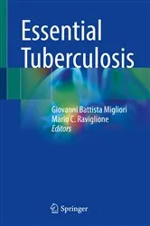 Book cover of Essential Tuberculosis by Giovanni Battista Migliori