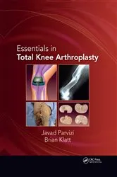 Book cover of Essentials in Total Knee Arthroplasty by Javad Parvizi
