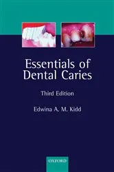 Book cover of Essentials of Dental Caries (3rd ed.) by Edwina Kidd