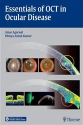 Book cover of Essentials of OCT in Ocular Disease by Amar Agarwal