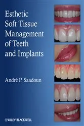 Book cover of Esthetic Soft Tissue Management of Teeth and Implants by Andre P. Saadoun
