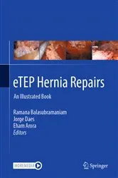 Book cover of eTEP Hernia Repairs by Ramana Balasubramaniam
