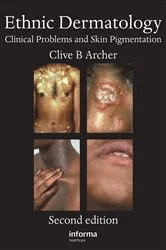 Book cover of Ethnic Dermatology (2nd ed.) by Clive B. Archer