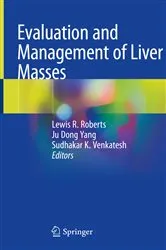 Book cover of Evaluation and Management of Liver Masses by Lewis R. Roberts