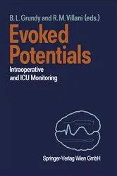 Book cover of Evoked Potentials by Betty L. Grundy