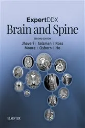 Book cover of ExpertDDx: Brain and Spine E-Book (2nd ed.) by Karen L. Salzman MD