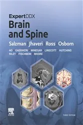 Book cover of ExpertDDx: Brain and Spine E-Book (3rd ed.) by Karen L. Salzman MD