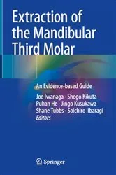 Book cover of Extraction of the Mandibular Third Molar by Joe Iwanaga