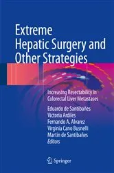 Book cover of Extreme Hepatic Surgery and Other Strategies by Eduardo de Santibañes