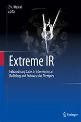 Book cover of Extreme IR by Ziv J Haskal