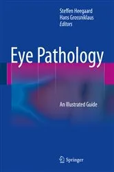 Book cover of Eye Pathology by Steffen Heegaard