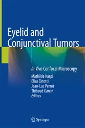 Book cover of Eyelid and Conjunctival Tumors by Mathilde Kaspi