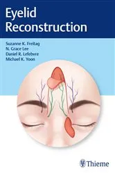 Book cover of Eyelid Reconstruction by Unknown