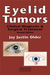 Book cover of Eyelid Tumors (2nd ed.) by Jay Justin Older