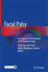 Book cover of Facial Palsy by Chieh-Han John Tzou