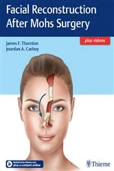 Book cover of Facial Reconstruction After Mohs Surgery by James Thornton