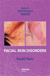 Book cover of Facial Skin Disorders by Ronald Marks